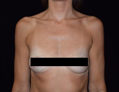B&A