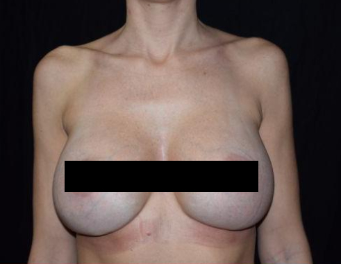 B&A