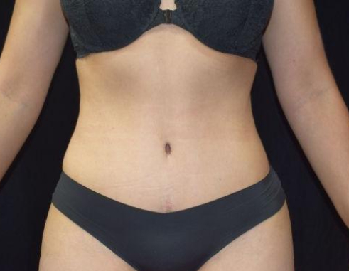 B&A