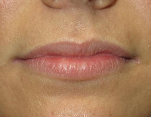 B&A