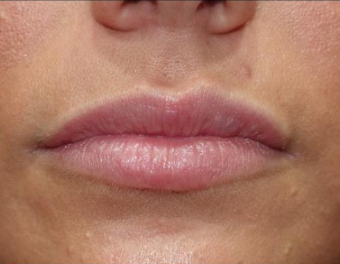 B&A